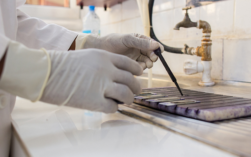 Des mains en gants manipulant des échantillons dans un laboratoire.