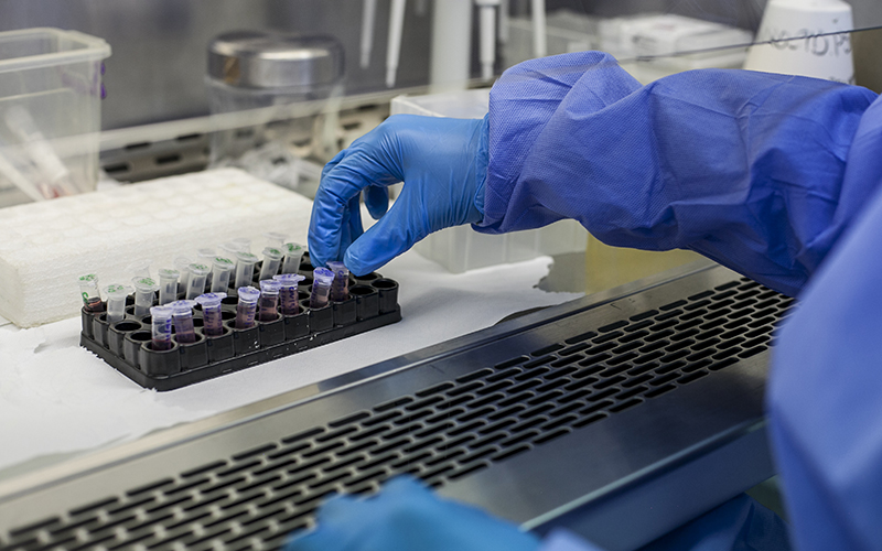 Scientist handling samples in a laboratory, wearing a blue lab coat and gloves.